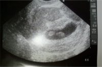 ultrasoundpic.jpg