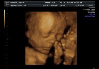 baby_2.jpg