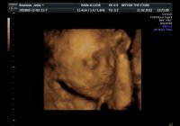 baby_30.jpg