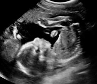 21weekUltrasoundBody2.jpg