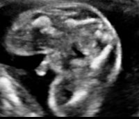 21weekUltrasoundG3.jpg