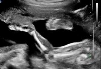21weekultrasoundLeg3.jpg