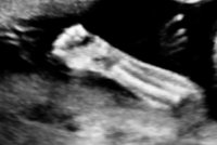 21weeUltrasoundArm.jpg