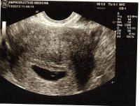 6 weeks.jpg