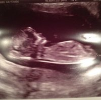 baby13weeks.jpg