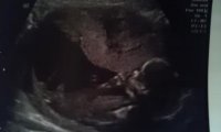 15wks6days.jpg