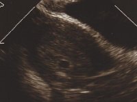 Ultrasound2 2:15.jpg