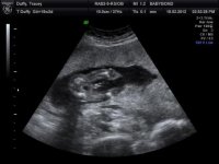 BABYBOND CHESTER_2.JPG