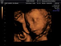 BABYBOND_5.jpg