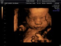 BABYBOND_18.jpg