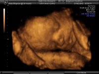 BABYBOND_16.jpg