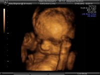 BABYBOND_17.jpg