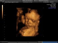 BABYBOND_24.jpg