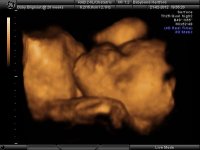 BABYBOND_36.jpg