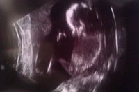 16 weeks and 3 days.jpg