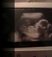 20 weeks.jpg