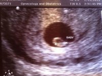 6wks 5days US.jpg