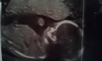 18wks5days.jpg