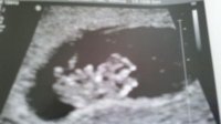 Baby A - 9 weeks.jpg
