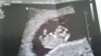 Baby B - 9 weeks.jpg