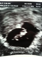 Baby W 7+2.jpg