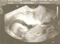 Ultrasound - February 28, 2012 - 3.jpg