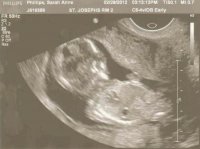 Ultrasound - February 28, 2012 - 4.jpg