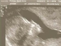 Ultrasound - February 28, 2012 - 5.jpg