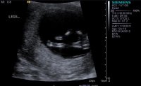 20120203093432812.jpg