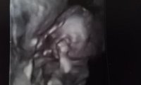 19wks6days3D.jpg