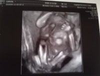 19wks6daysBOY.jpg