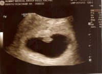 3-7-12 Scan--7w+1 day.jpg