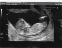 12 weeks 3 days pregnant. 15th December 2011.jpg
