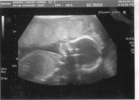 20-week.jpg