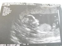 baby a 14 weeks.jpg