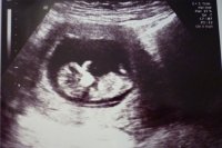 09.03.12 11 weeks and 3 days scan (small).jpg