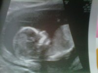 13+5 baby head.jpg
