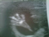 13+5 Baby Hand.jpg