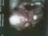 Sophie 18 wk 3d.jpg