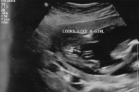 ultrasound3.jpg