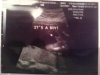 haiden 20 week scan2.jpg