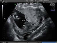 BABY GIRL_4.jpg