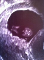11 week tushie.jpg