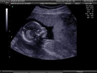 baby.jpg
