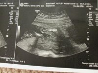 baby sono 007.jpg