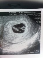 fetal pole.jpg