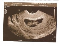 Baby 9w.jpg