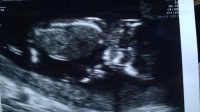 12weeks6days.jpg