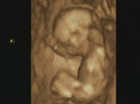 Baby A_3D.jpg
