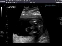 babygender.jpg